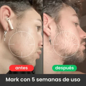 APOLO Ultra-Potent Beard Growth Balm 100 ml (Minoxidil 20%) - Image 2