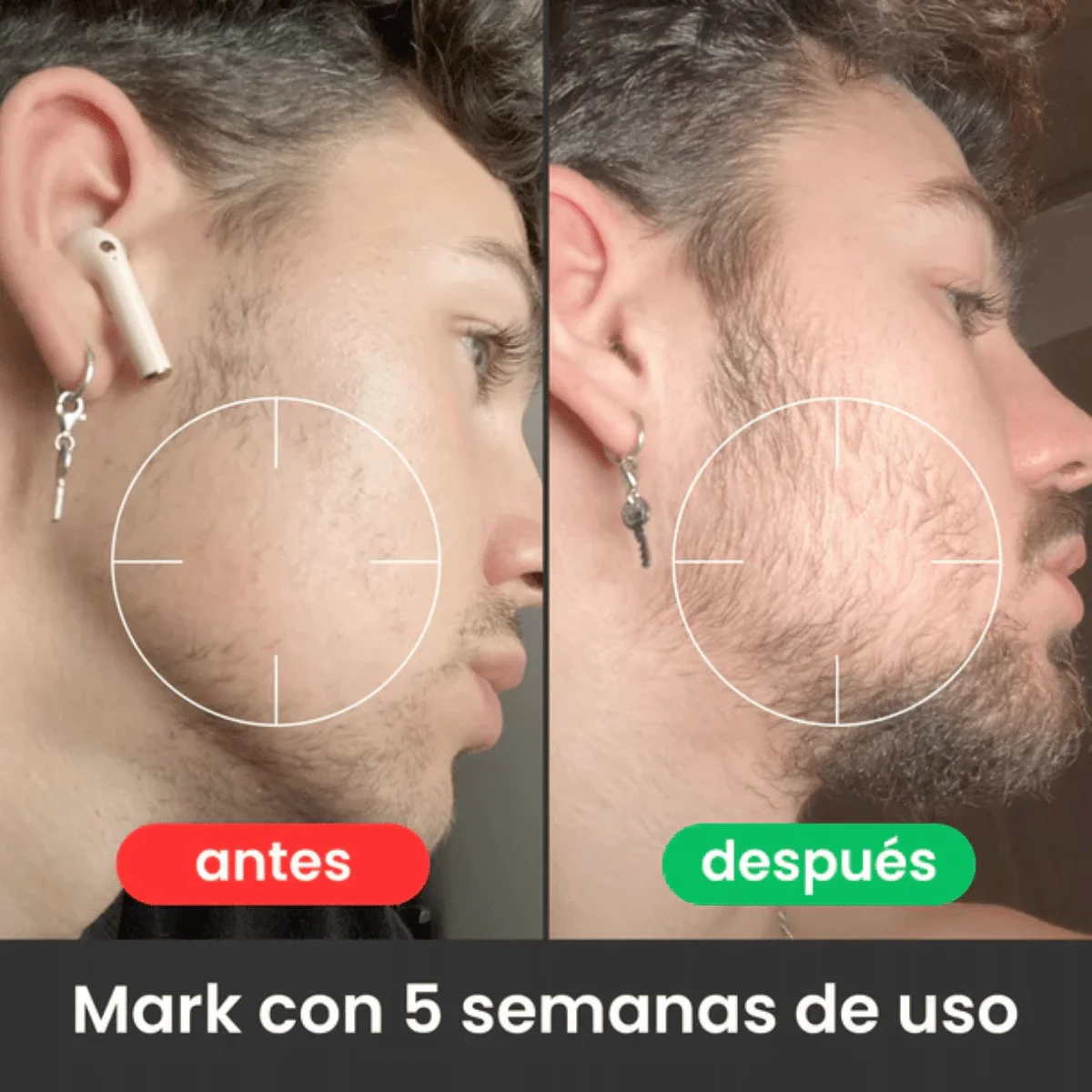 APOLO Ultra-Potent Beard Growth Balm 100 ml (Minoxidil 20%) - Image 2