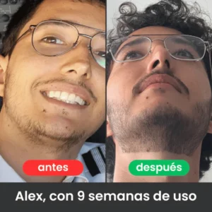 APOLO Ultra-Potent Beard Growth Balm 100 ml (Minoxidil 20%) - Image 3