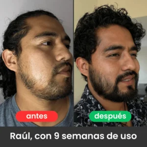 APOLO Ultra-Potent Beard Growth Balm 100 ml (Minoxidil 20%) - Image 5